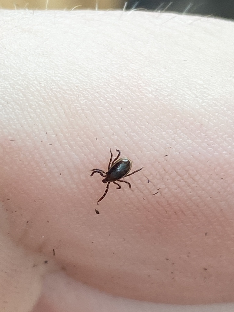 Blacklegged tick (Ixodes scapularis) — close-up on skin showing the long mouthparts characteristic of Ixodes.